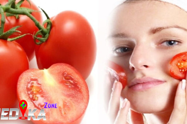 Cara Mudah Menghilangkan Jerawat dengan Tomat di Sini